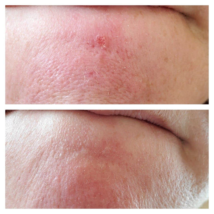 Three Ships Refresh Papaya + Sakicylic Acid Foaming Cleanser for Oily/Combination Skin  100ml