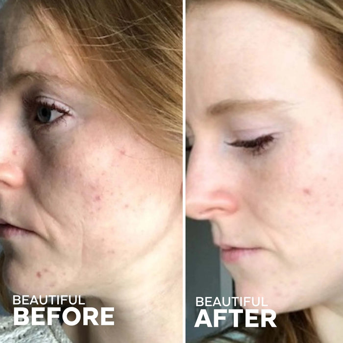 Three Ships In the Clear 3-Step Kit for Acne Prone Skin 1kit