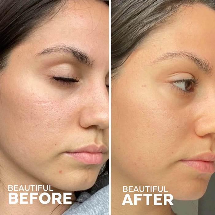 Three Ships In the Clear 3-Step Kit for Acne Prone Skin 1kit